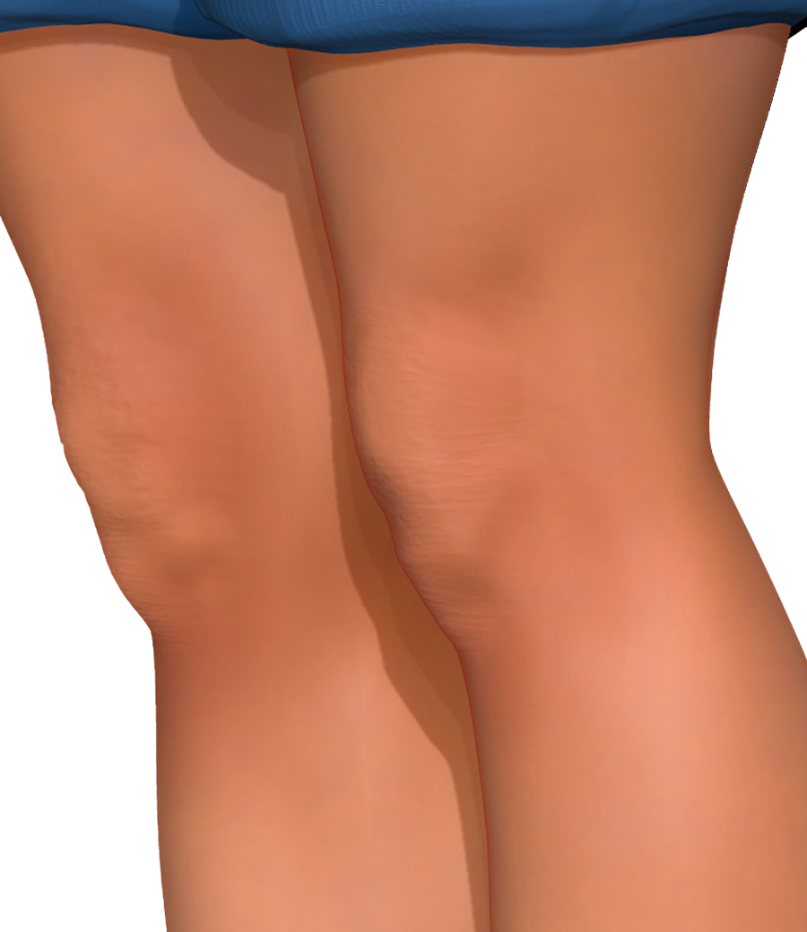outside of knee pain causes painspot